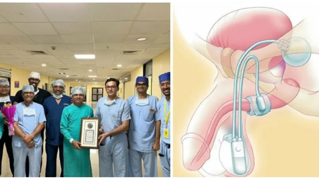 Advanced Artificial Urinary Sphincter (AUS) implantation service launched at AIIMS Bhubaneswar 